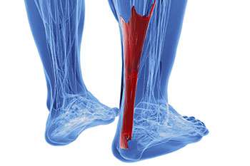Achilles tendon treatment in the Ocean County, NJ: Toms River (Beachwood, Berkeley Township, Lacey Township, Ocean Twp, Anchorage, Brick Township, Seaside Heights, Lavallette, Barnegat Township, Manchester Township, Lakehurst) area
