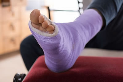 Foot and ankle fractures treatment in the Ocean County, NJ: Toms River (Beachwood, Berkeley Township, Lacey Township, Ocean Twp, Anchorage, Brick Township, Seaside Heights, Lavallette, Barnegat Township, Manchester Township, Lakehurst) area