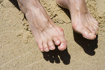 Hammertoe treatment in the Mercer County, NJ: Hamilton (Trenton, Windsor, Lawrence Township, Ewing Township, Broad Street Park, Groveville, Robbinsville Twp, Pennington, Rosedale, Princeton), Ocean County, NJ: Toms River (Beachwood, Berkeley Township, Lacey Township, Ocean Twp, Anchorage, Brick Township, Seaside Heights, Lavallette, Barnegat Township, Manchester Township, Lakehurst) and Middlesex County, NJ: Plainsboro Township (Cranbury, Deans, South Brunswick Township, Applegarth, Monroe Township, Jamesburg, Helmetta, Spotswood) areas