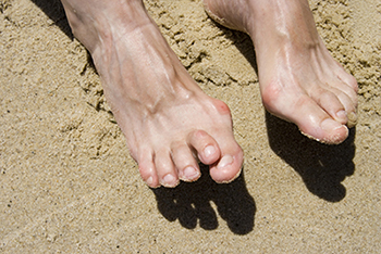 Hammertoe treatment in the Ocean County, NJ: Toms River (Beachwood, Berkeley Township, Lacey Township, Ocean Twp, Anchorage, Brick Township, Seaside Heights, Lavallette, Barnegat Township, Manchester Township, Lakehurst) area