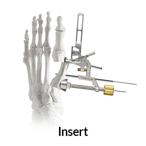 nanoplasty