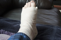 Medical Attention for a Broken Foot