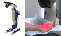 Healing Achilles Pain With Therapeutic Laser